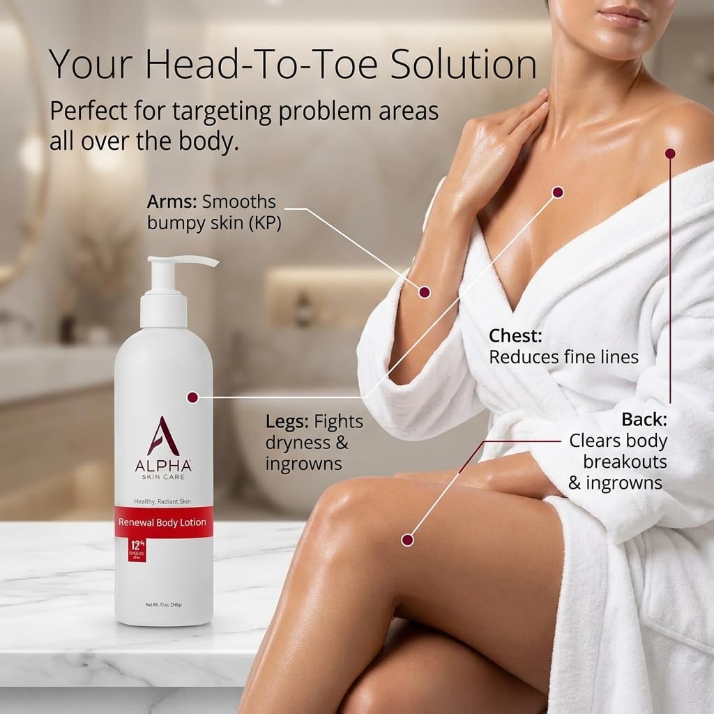 Alpha Skin Care Revitalizing Body Lotion, 12% Glycolic AHA, Daily Moisturizer, Hydrates & Exfoliates, Anti-Aging, 12 Oz 🍁 All In One Marketplace Canada