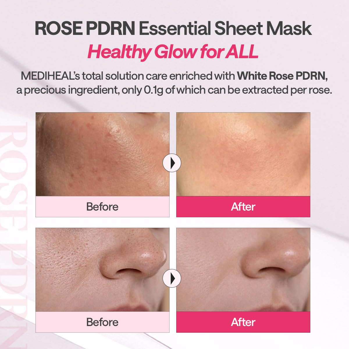 MEDIHEAL Rose PDRN Essential Face Mask - Healthy Glow with Squalane & Vitamin C, Hydrating & Firming, Pore Minimizer & Moisture Barrier, Vegan, Korean Skincare for Women (10 Sheets) 🍁 All In One Marketplace Canada