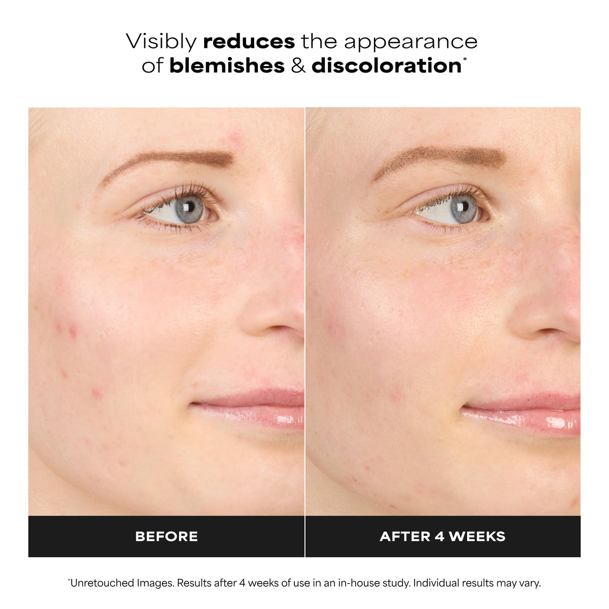 Paula's Choice BOOST 10% Azelaic Acid Booster Cream Gel, Licorice Extract & Salicylic Acid, Oil-Free Skin Serum, Fragrance-Free, 30 ml 🍁 All In One Marketplace Canada