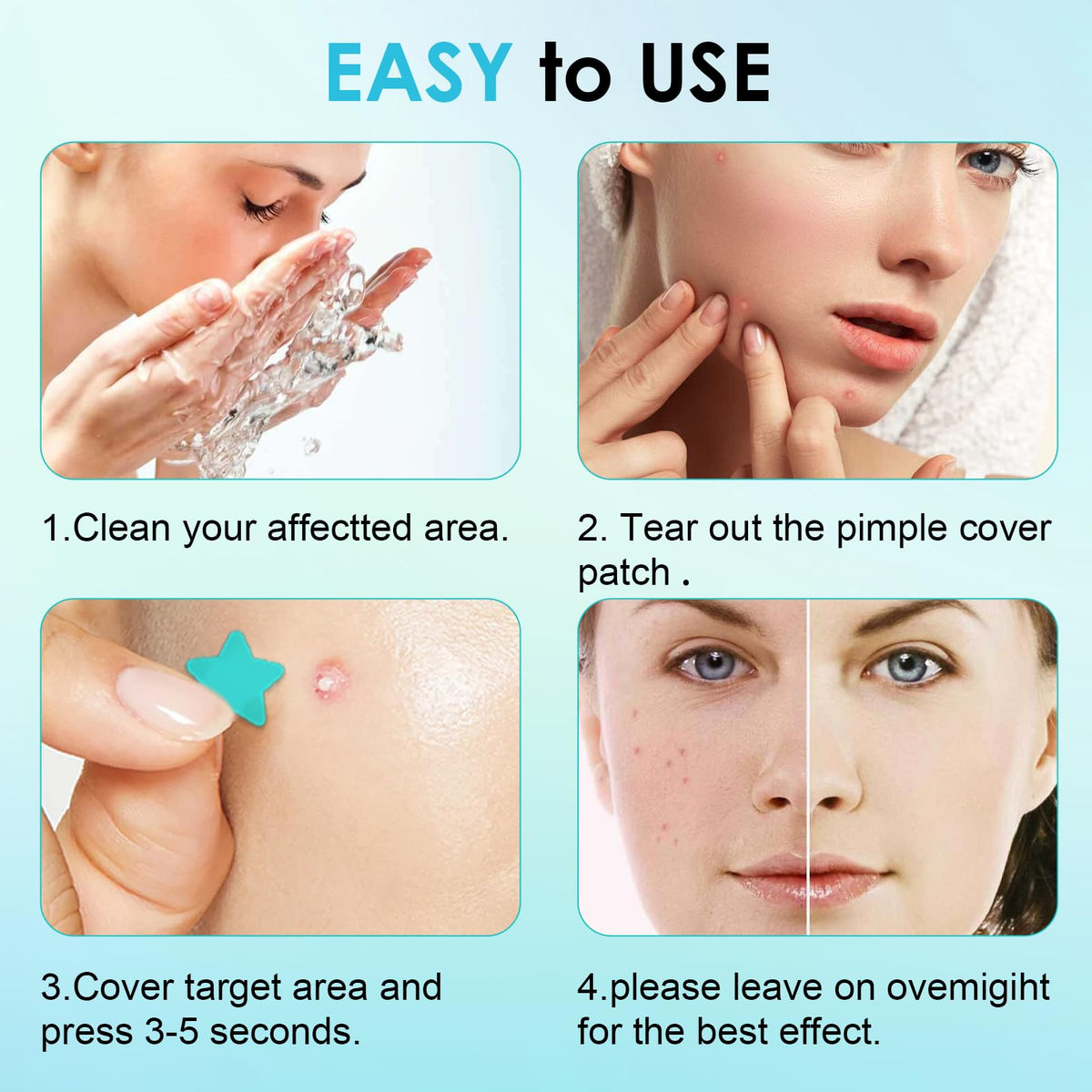 320 PCS Pimple Patch Star Invisible Ultra Thin Star-shaped Pimple Patches Colorful Hydrocolloid Patch Skin Care for Face 🍁 All In One Marketplace Canada