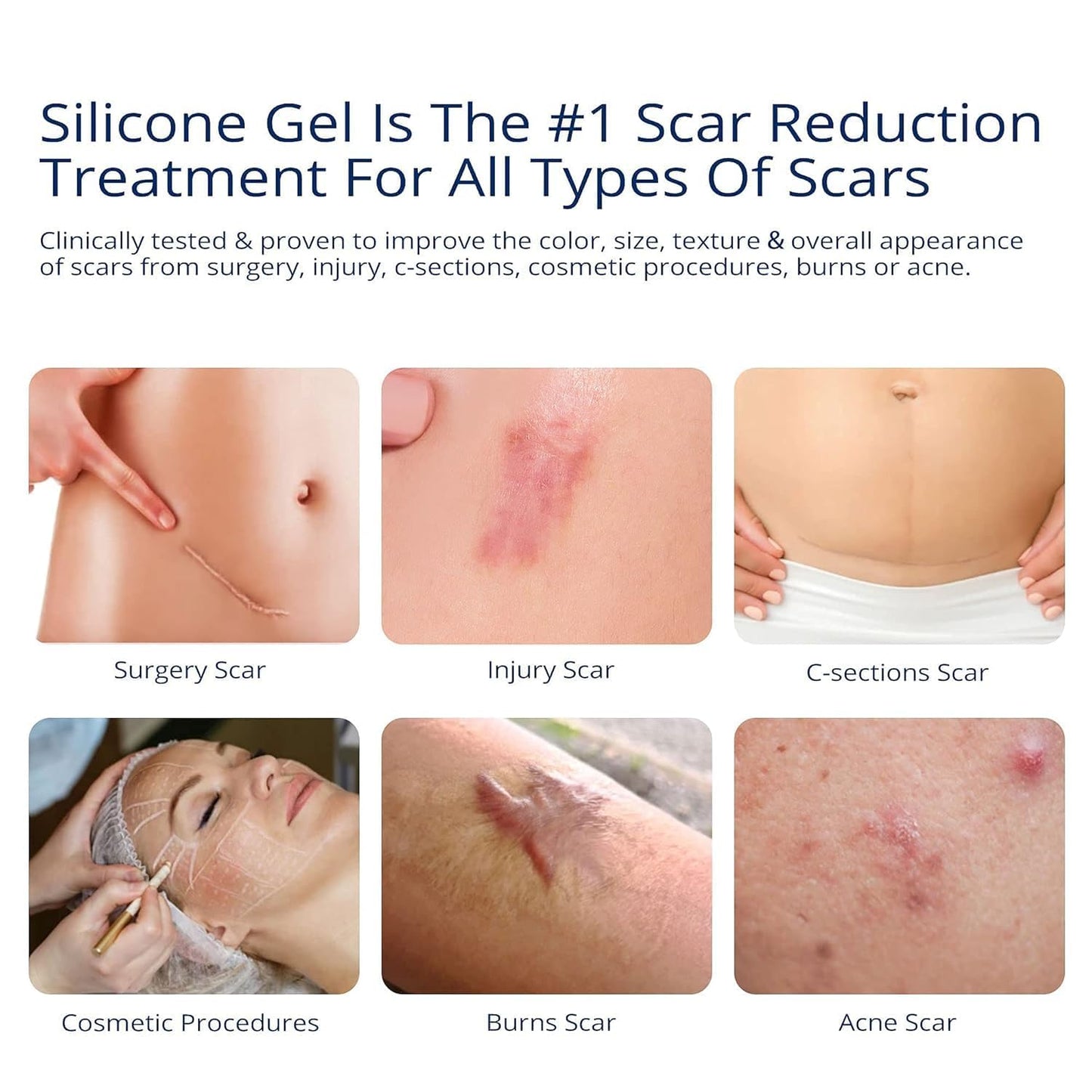 100% Silicone Scar Gel Scar Cream - Advanced Scar Gel for Old and New Scars 🍁 All In One Marketplace Canada