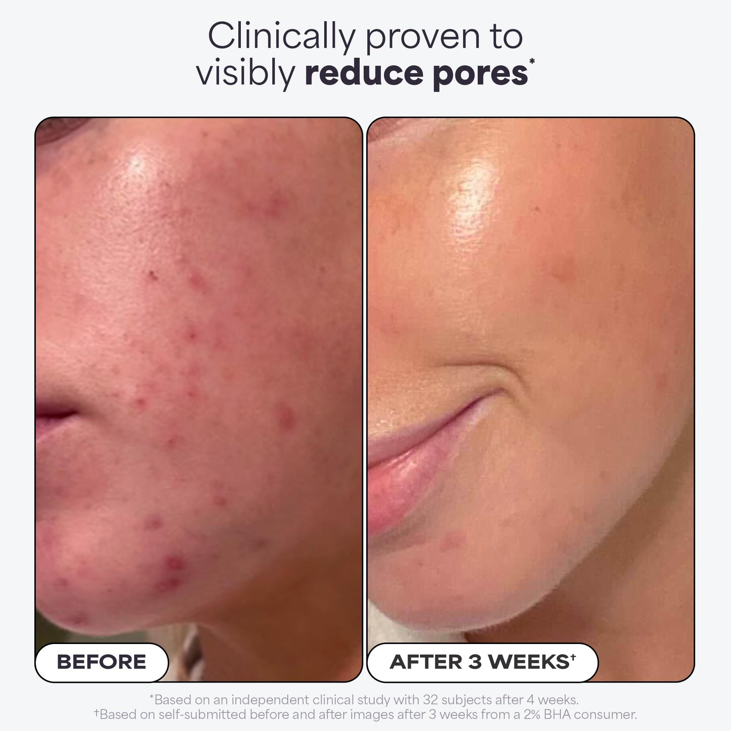 Paula's Choice SKIN PERFECTING 2% BHA Liquid Salicylic Acid Exfoliant Duo, Gentle Exfoliator for Enlarged Pores, Wrinkles & Fine Lines, Includes 1 Full Size Bottle & 1 Travel Size Bottle 🍁 All In One Marketplace Canada