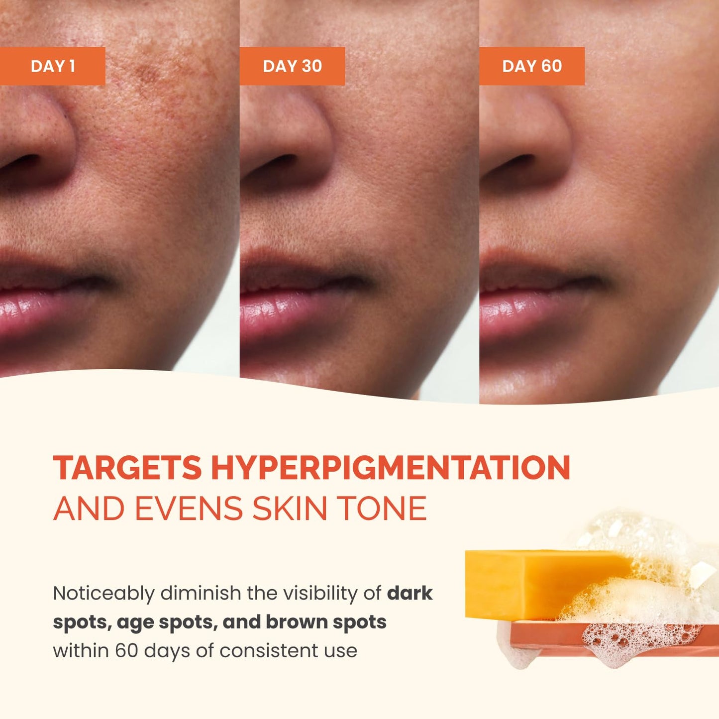 PLANTIFIQUE Turmeric & Kojic Acid Soap for Hyperpigmentation, Lab Tested - 4 Bars with Mesh Net - Face & Body Wash with Hyaluronic Acid, Collagen, Vitamin C - 320g / 11.28 oz 🍁 All In One Marketplace Canada