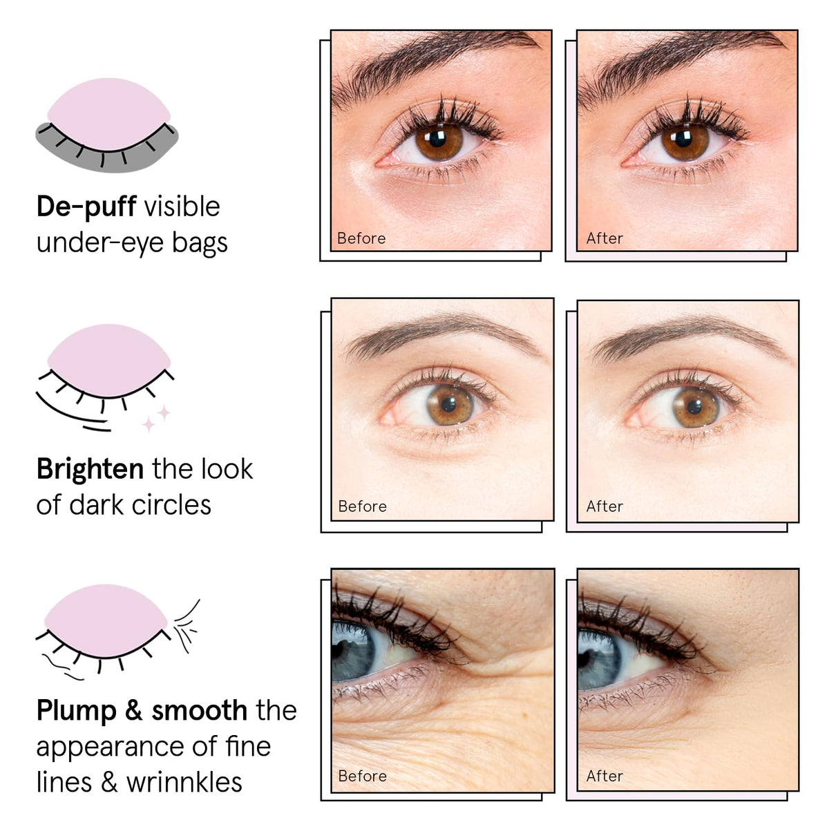 grace & stella Under Eye Patches (12 pairs) Eye Masks for Dark Circles and Puffiness - Birthday Gifts for Women, Bachelorette Party Favors, Bridesmaid Proposal Gifts, Self Care, Spa, Relaxation, Vegan 🍁 All In One Marketplace Canada