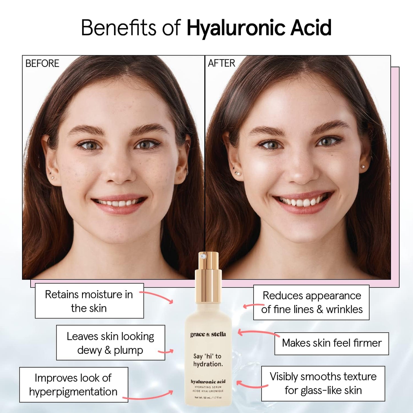 grace & stella Award Winning Hyaluronic Acid Serum for Face (50ml) Hydrating Hyaluronic Acid - Acide Hyaluronique Face - Anti Aging Serum to Hydrate, Remove Fine Lines, Wrinkles, Boost Collagen 🍁 All In One Marketplace Canada