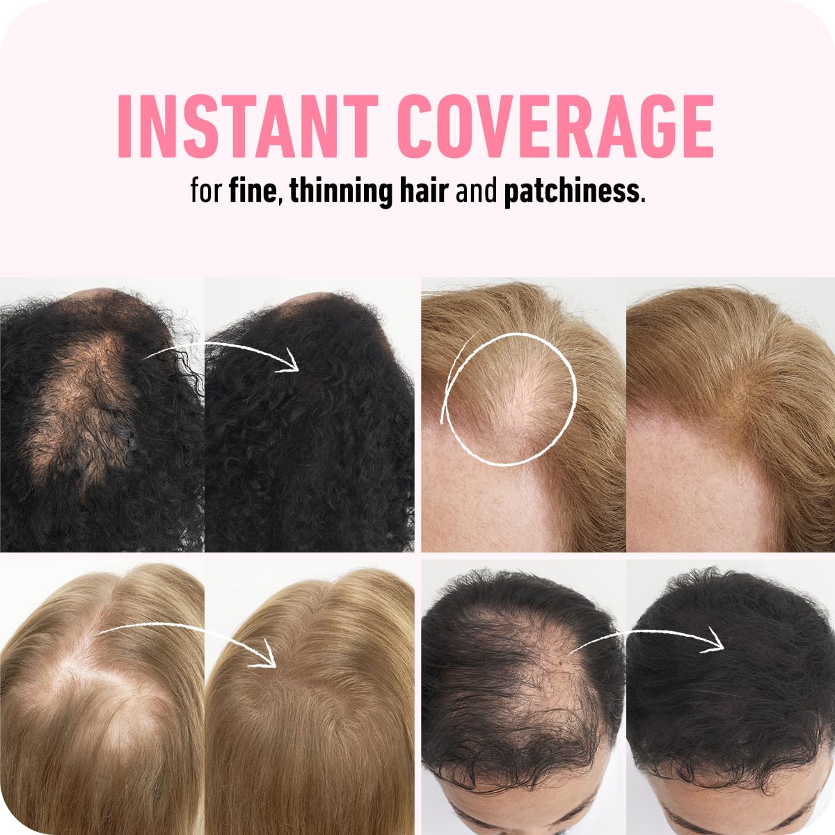 BOLDIFY Hair Fibers (28g) - Fill In Thinning and Fine Hair for an Instantly Fuller, Thicker Look - 14 Shades for Women & Men - Black 🍁 All In One Marketplace Canada