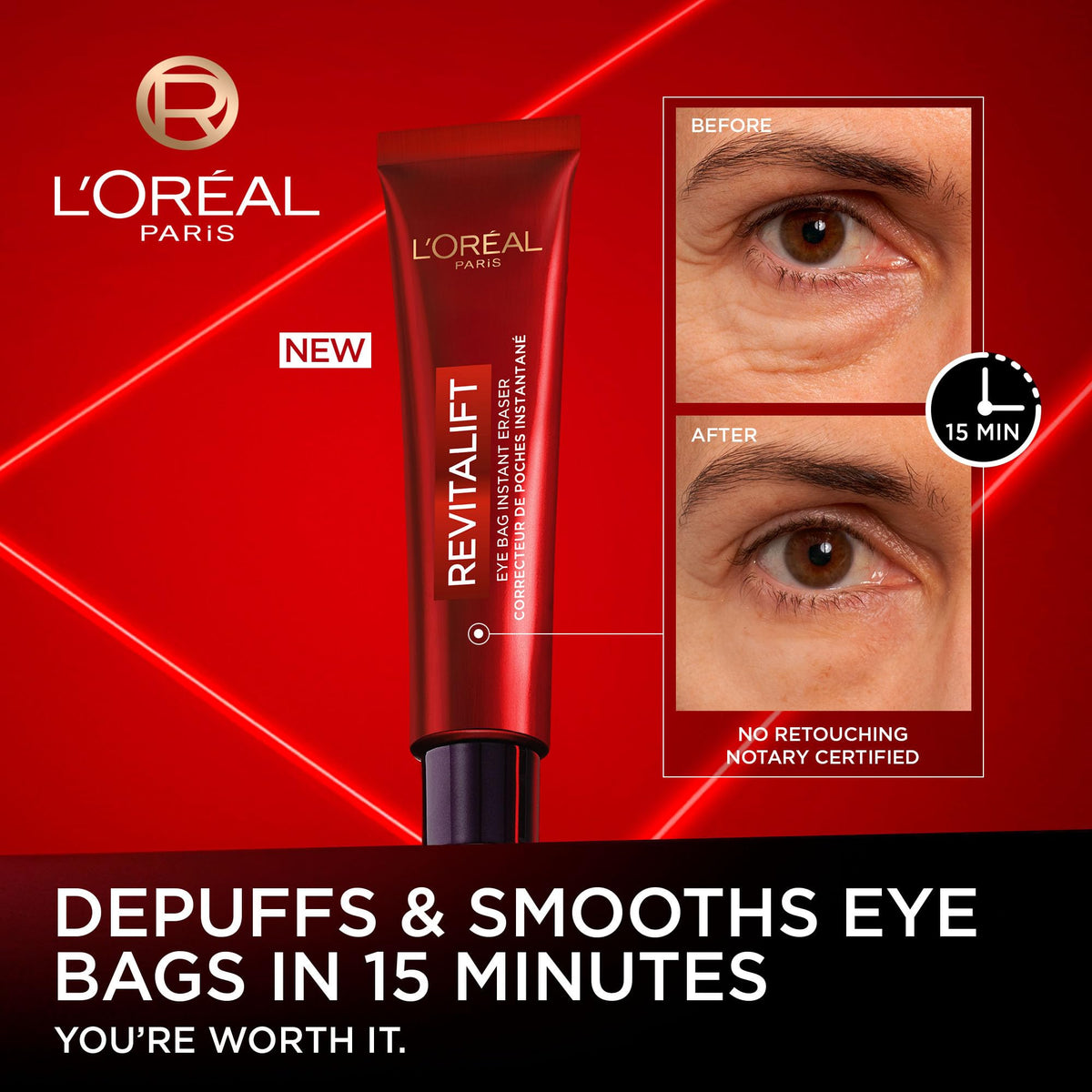 L'Oréal Paris Revitalift Triple Power LZR Instant Eraser Eye Cream, Under Eye Cream for Puffiness and Wrinkles, Anti Aging, Needle-Free Procedure Alternative, 15 mL 🍁 All In One Marketplace Canada