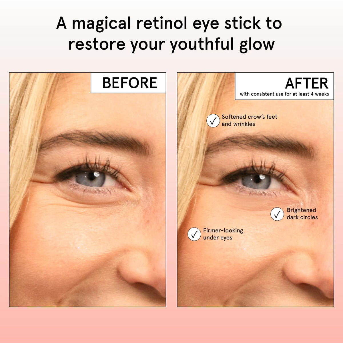 grace & stella Retinol & Caffeine Eye Cream Stick - Under Eye Cream for Dark Circles, Anti-Aging, Puffiness, Wrinkles, Undereye Bags - Brightener with Niacinamide - Vegan Skincare (0.13 oz/3.5 g) 🍁 All In One Marketplace Canada