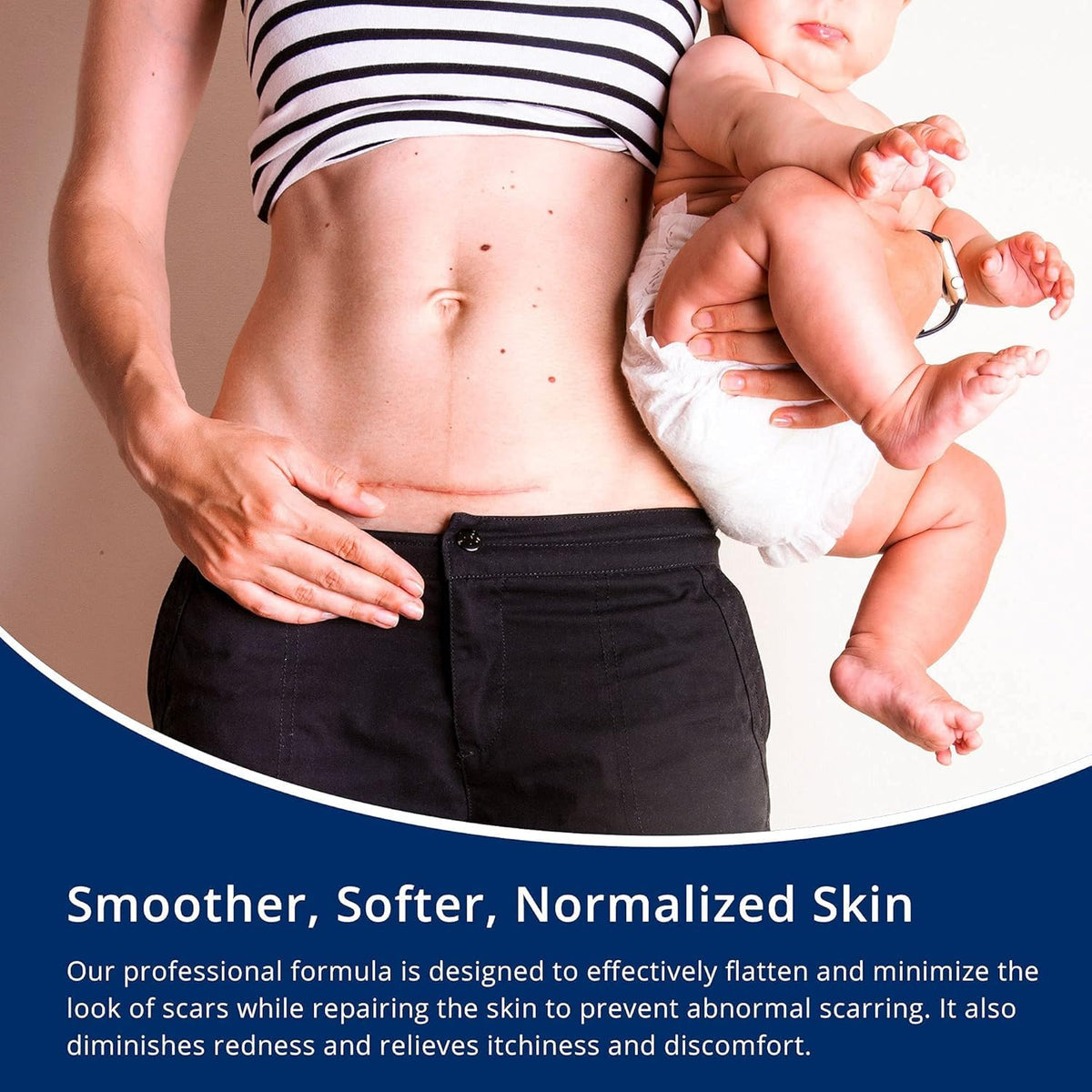 100% Silicone Scar Gel Scar Cream - Advanced Scar Gel for Old and New Scars 🍁 All In One Marketplace Canada