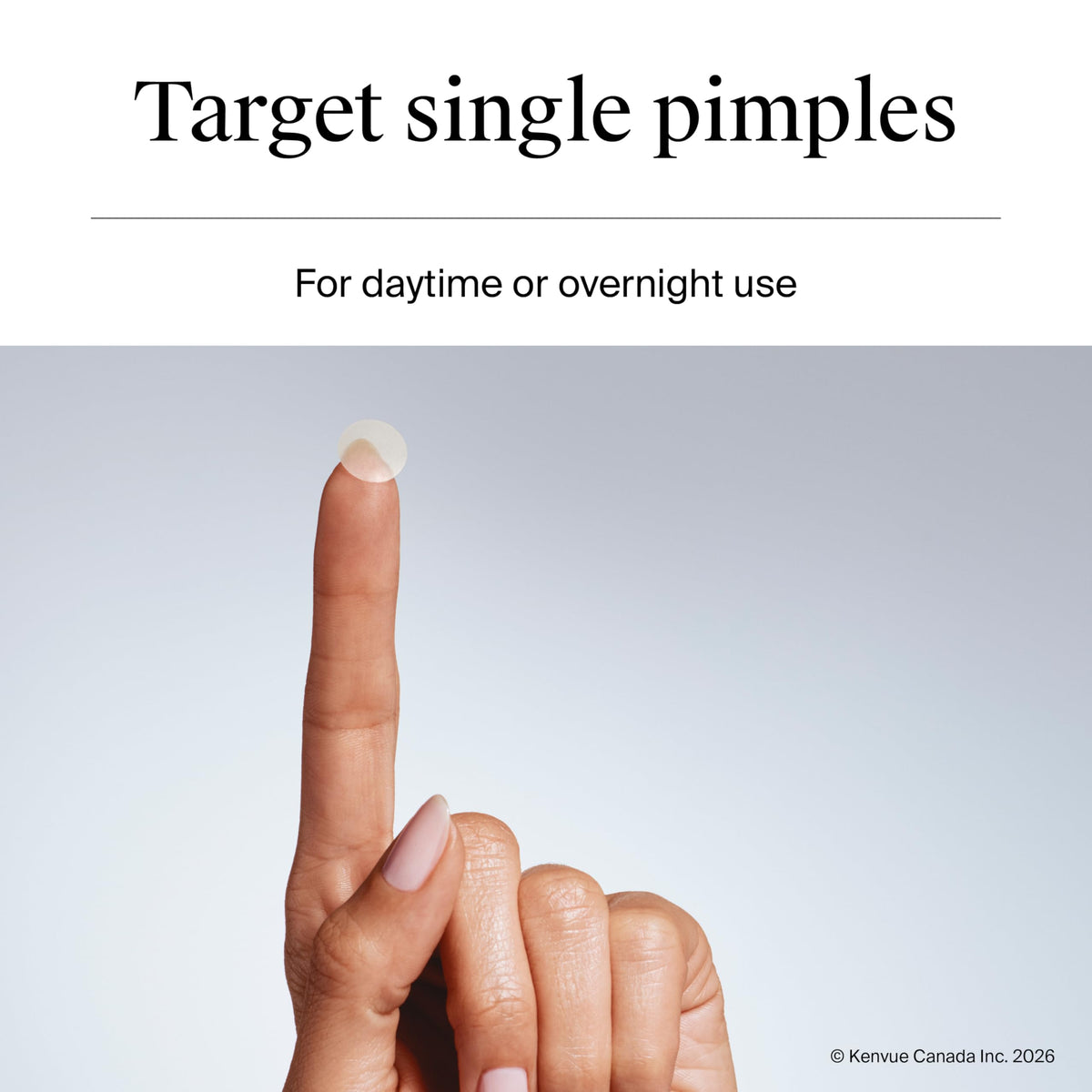 Neutrogena Stubborn Acne Blemish Pimple Patches, Hydrocolloid, 2x24 Pack 🍁 All In One Marketplace Canada