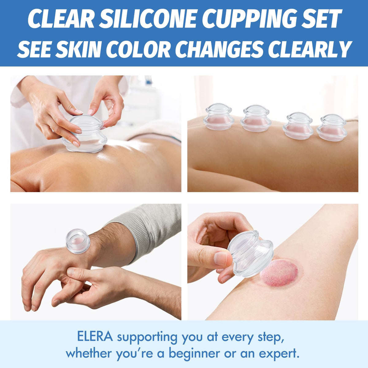 ELERA Silicone Cupping Therapy Set (3 Sizes, 7 Cups), Reusable Massage Cups for Deep Tissue, Cellulite, Face, Neck, Back, Joint, Body Relaxation 🍁 All In One Marketplace Canada