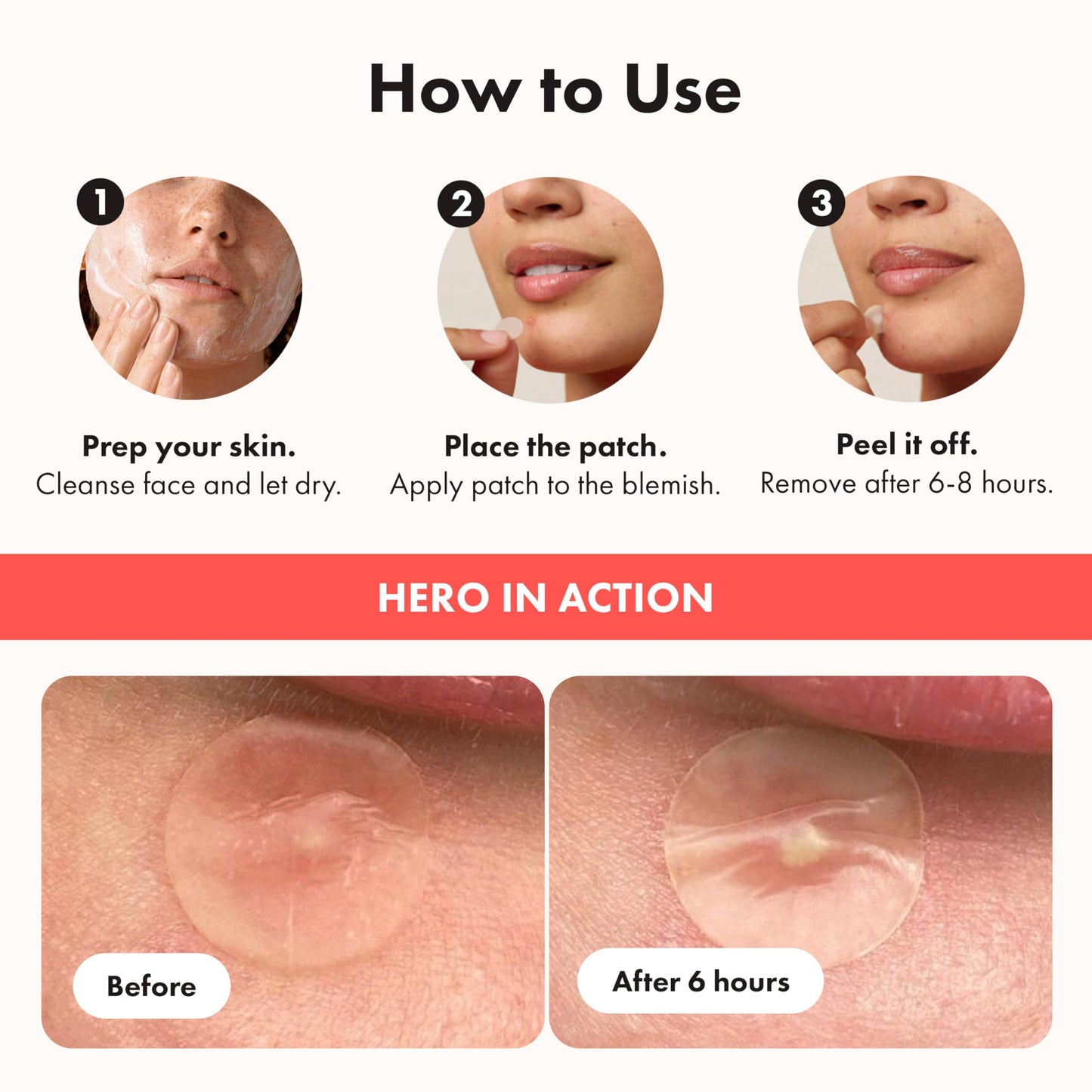 Hero Cosmetics Mighty Patch Original – Hydrocolloid Patch for Pimples, Overnight Acne Blemish & Zit Stickers for Sensitive Skin, 36 Count 🍁 All In One Marketplace Canada