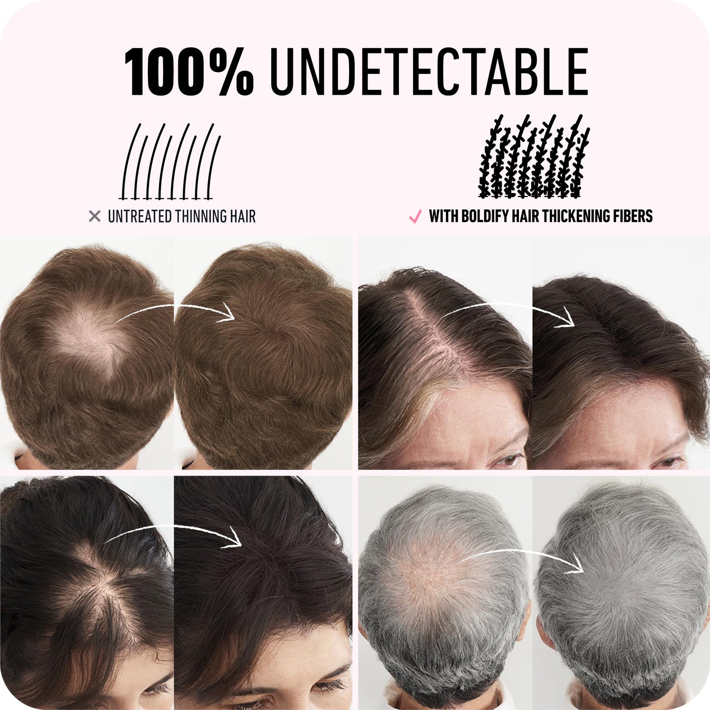 BOLDIFY Hair Fibers (28g) - Fill In Thinning and Fine Hair for an Instantly Fuller, Thicker Look - 14 Shades for Women & Men - Black 🍁 All In One Marketplace Canada