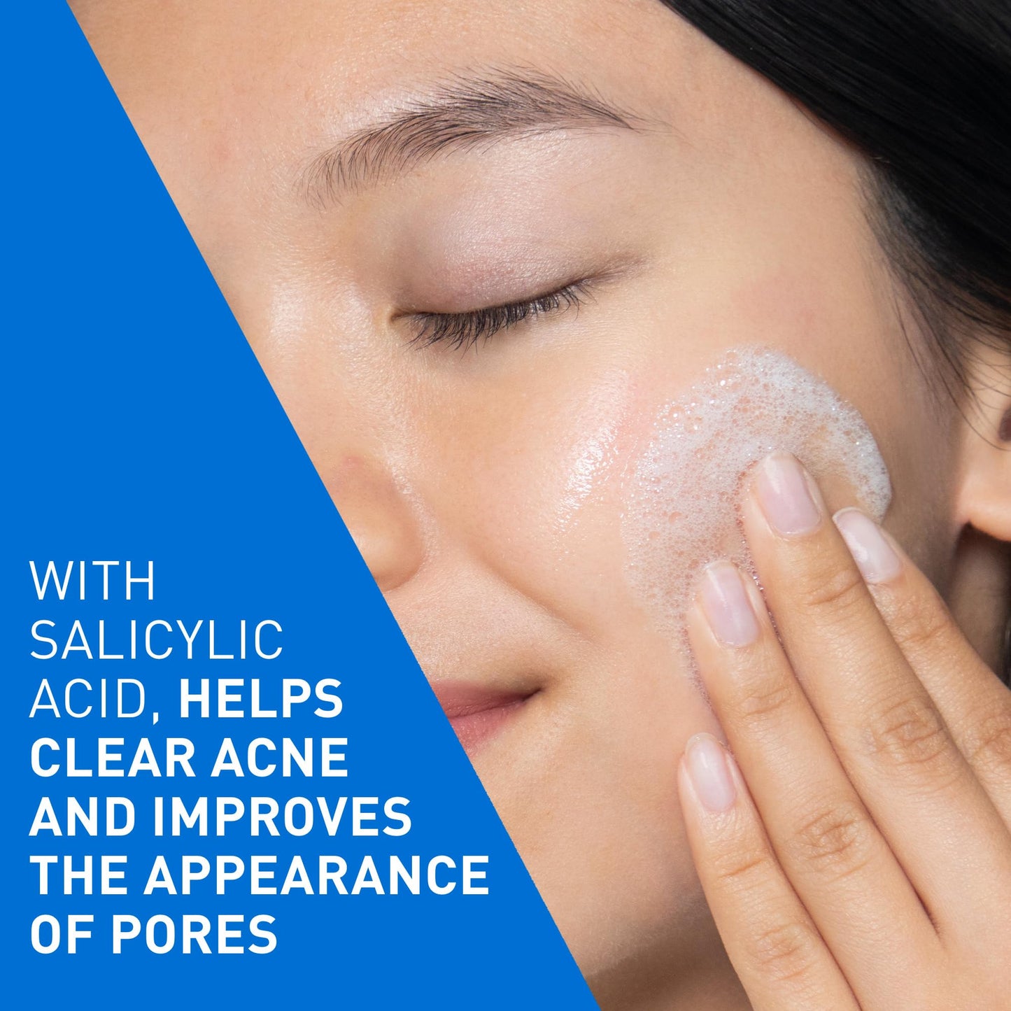CeraVe Acne Face Wash, 2% Salicylic Acid Cleanser with Purifying Clay & Niacinamide for Oily Skin and Blackheads, Fragrance-Free, Paraben-Free & Non-Comedogenic, 473 mL 🍁 All In One Marketplace Canada