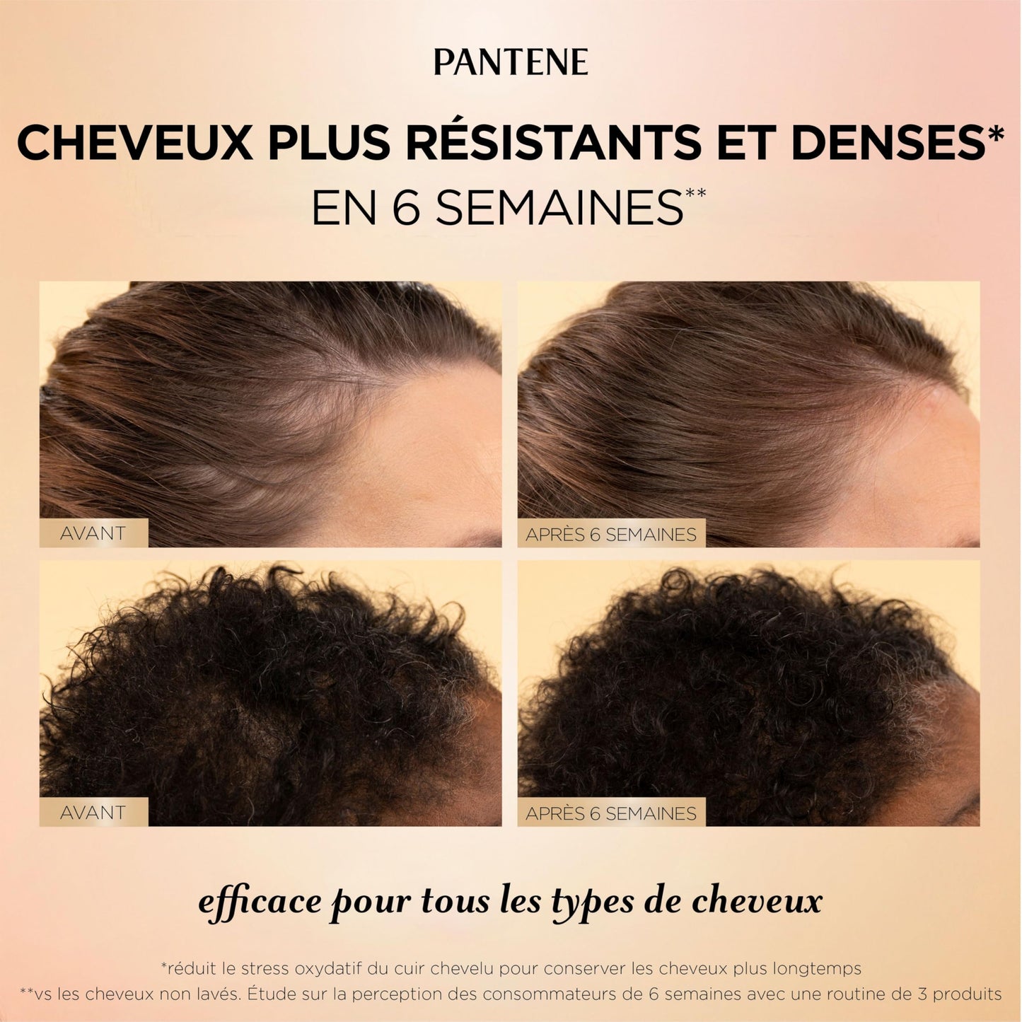 Pantene Abundant & Strong 3-Step System, Shampoo (400 ml), Conditioner (236 ml), Serum (60 ml), Strengthens at the Root, 3 Count 🍁 All In One Marketplace Canada
