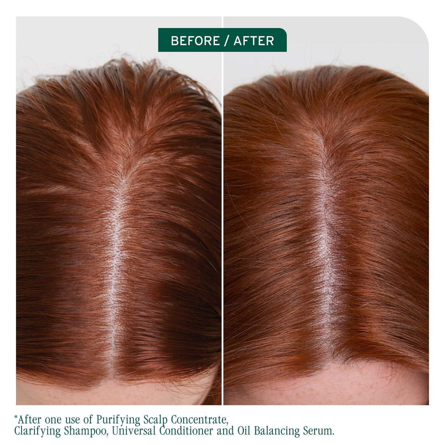 Biolage Scalp Sync Clarifying Shampoo for Oily Scalp 🍁 All In One Marketplace Canada