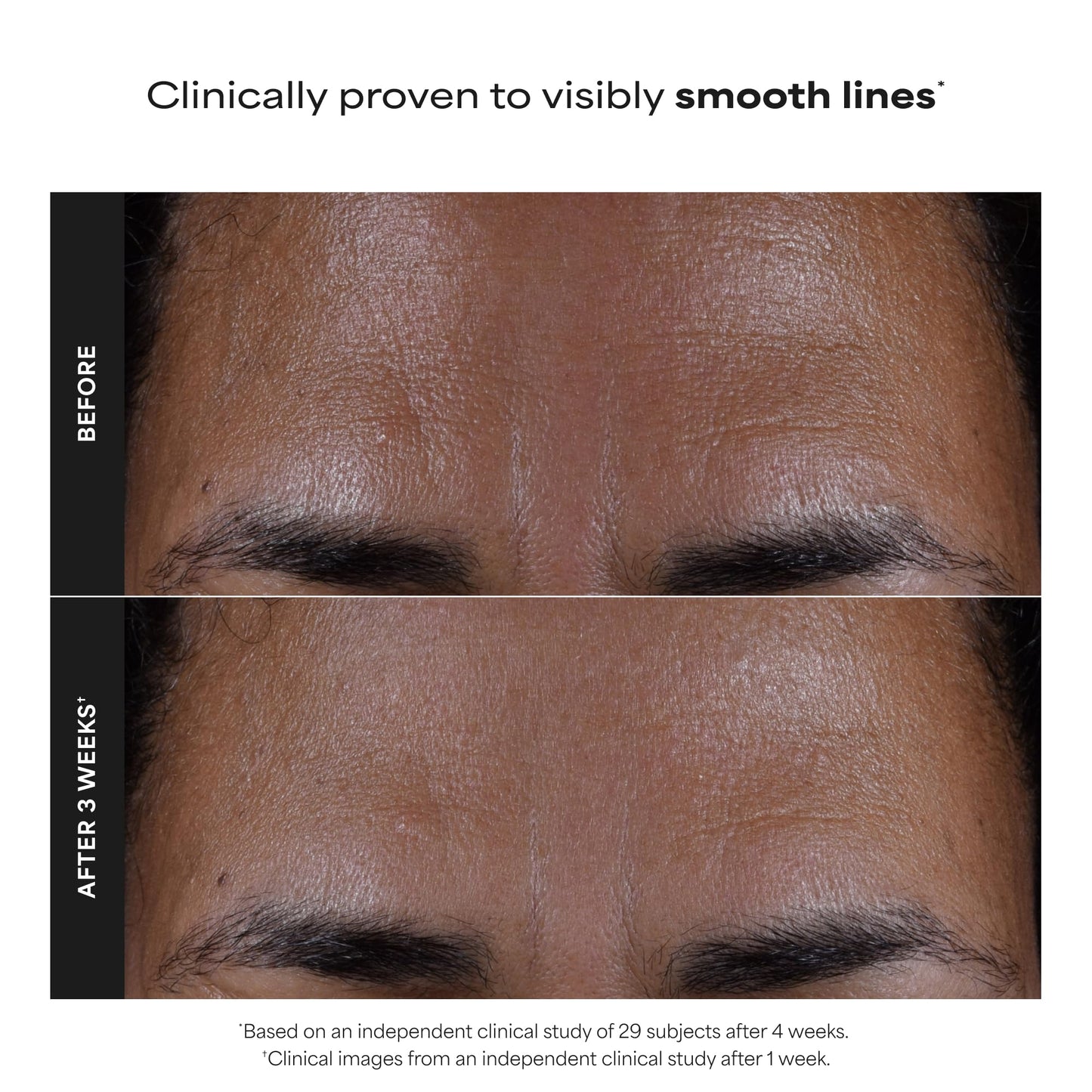 Paula's Choice SKIN PERFECTING 2% BHA Liquid Salicylic Acid Exfoliant, Daily Facial Exfoliator for Enlarged Pores, Wrinkles & Fine Lines, Fragrance-Free, Travel Size - 30 ml 🍁 All In One Marketplace Canada