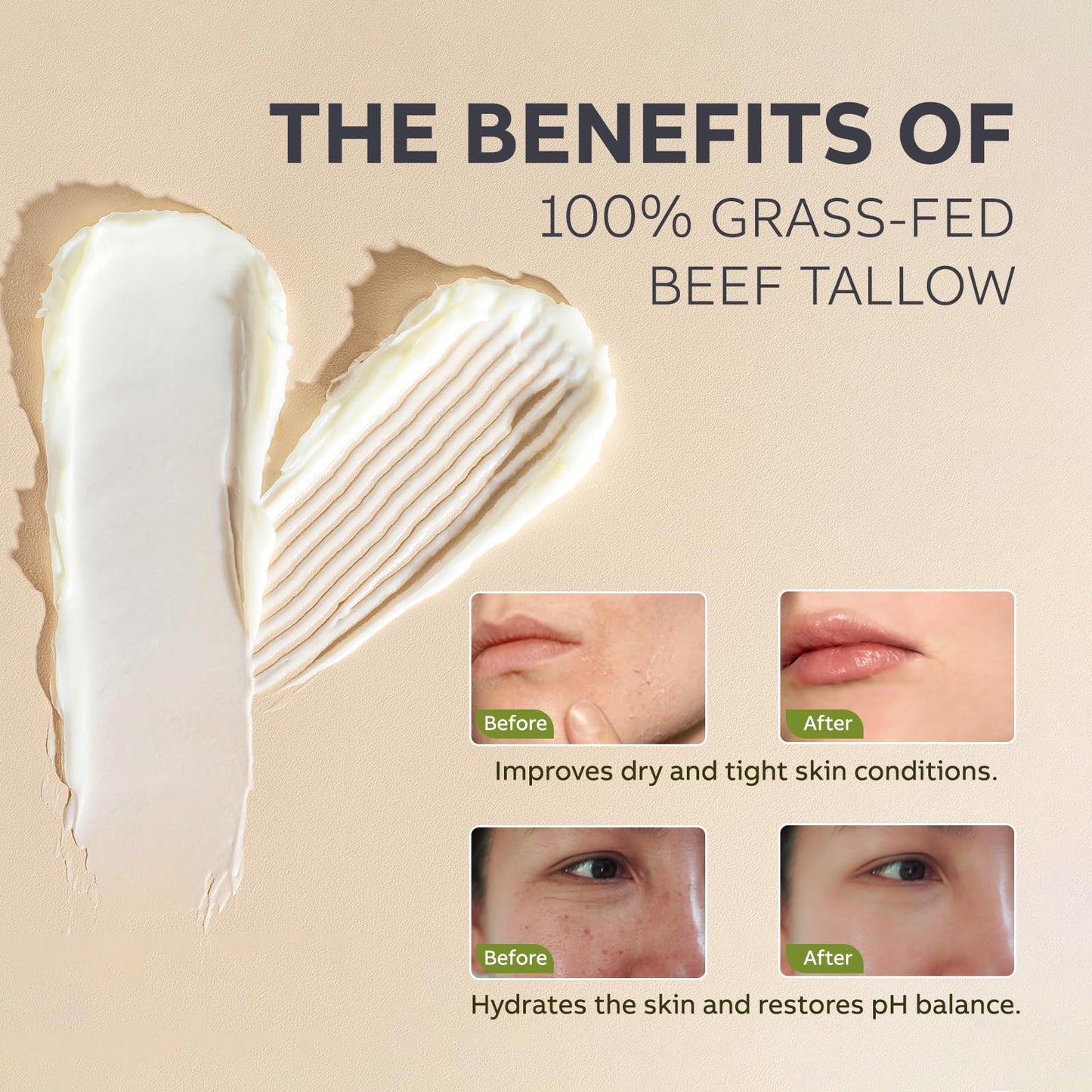 Beef Tallow and Honey Balm for Skin: Whipped Grass Fed Beef Tallow Balm Moisturizer with Raw Honey and Olive Oil for Face and Body - Natural Cow Fat Cream Unscented 🍁 All In One Marketplace Canada
