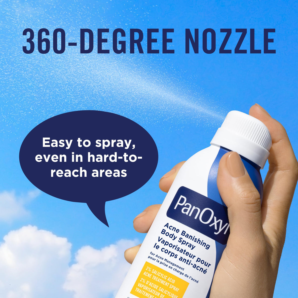 PanOxyl Acne Banishing Body Spray with 2% Salicylic Acid, Pimple Treatment to Help Clear Stubborn Breakouts, 360-Degree Spray Nozzle, Skin-Brightening Niacinamide, Vitamin C, Witch Hazel, Aloe, 170g 🍁 All In One Marketplace Canada
