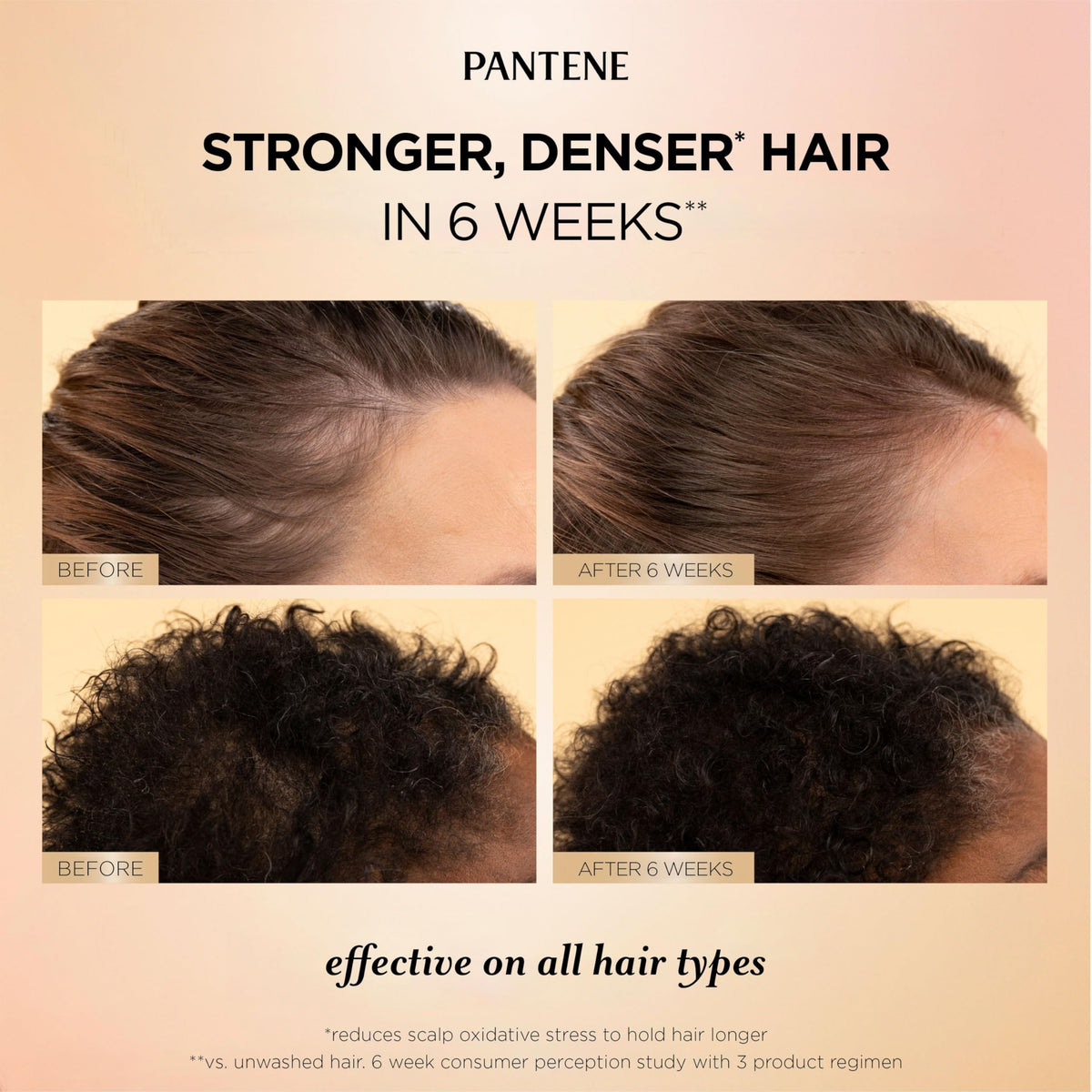 Pantene Abundant & Strong Daily Scalp Serum, Strengthens Scalp’s Hold on Roots, 60 ml 🍁 All In One Marketplace Canada