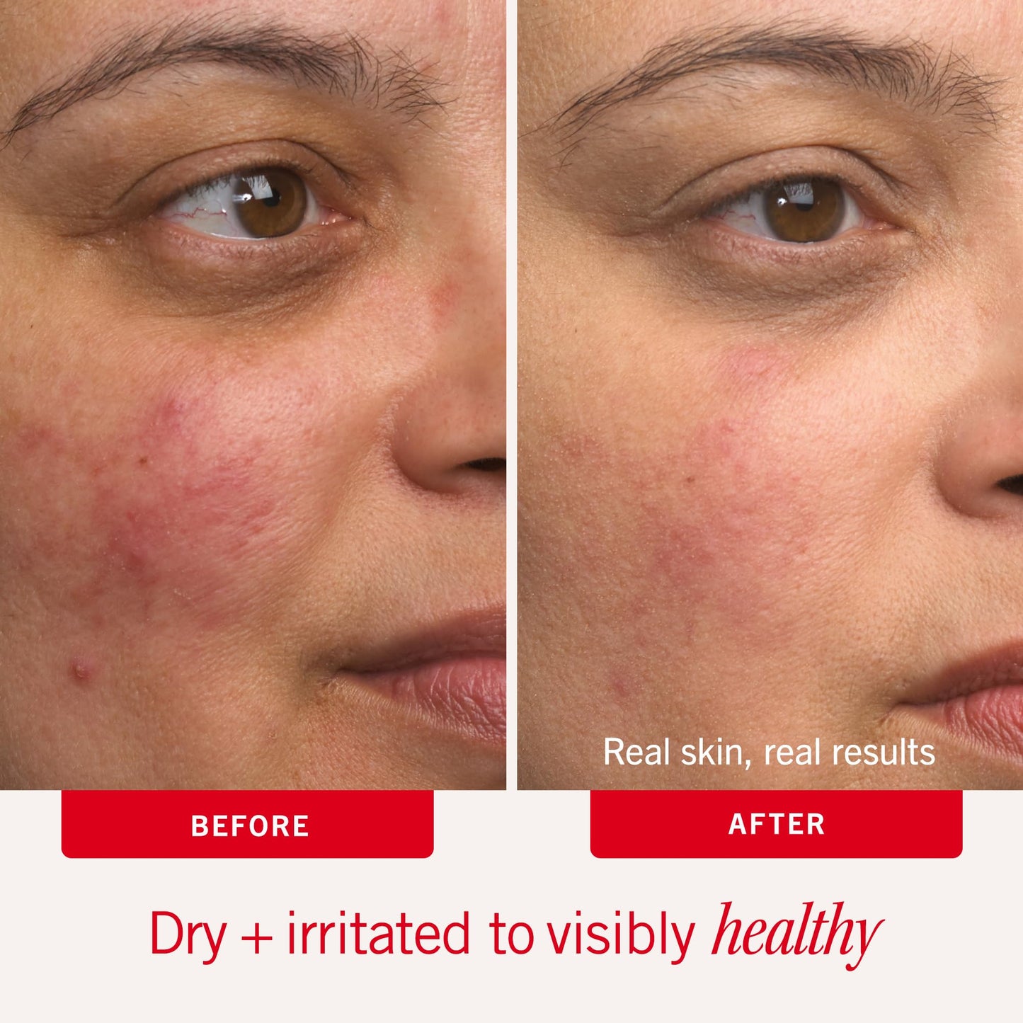 First Aid Beauty - Ultra Repair Cream - Intense Hydration Face & Body Moisturizer - Whipped Colloidal Oatmeal Clinically Proven to Strengthen Skin Barrier in 7 Days - Helps Relieve Eczema, 6 oz 🍁 All In One Marketplace Canada