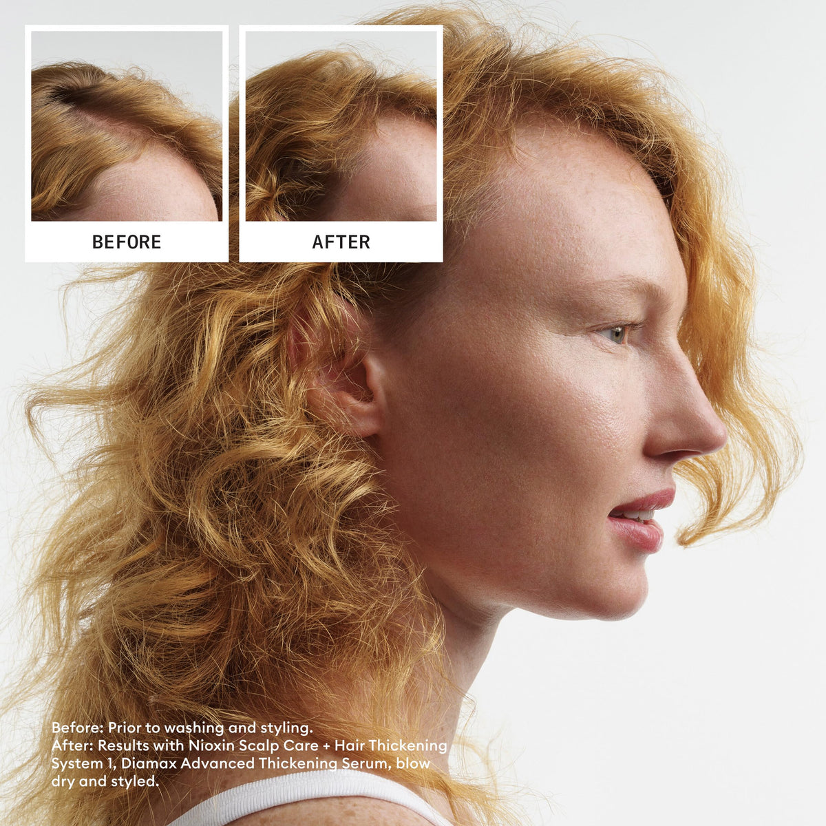 Nioxin System 4 Scalp + Hair Shampoo - Hair Thickening Shampoo For Damaged Hair with Progressed Thinning, 10 fl oz (Packaging May Vary) 🍁 All In One Marketplace Canada