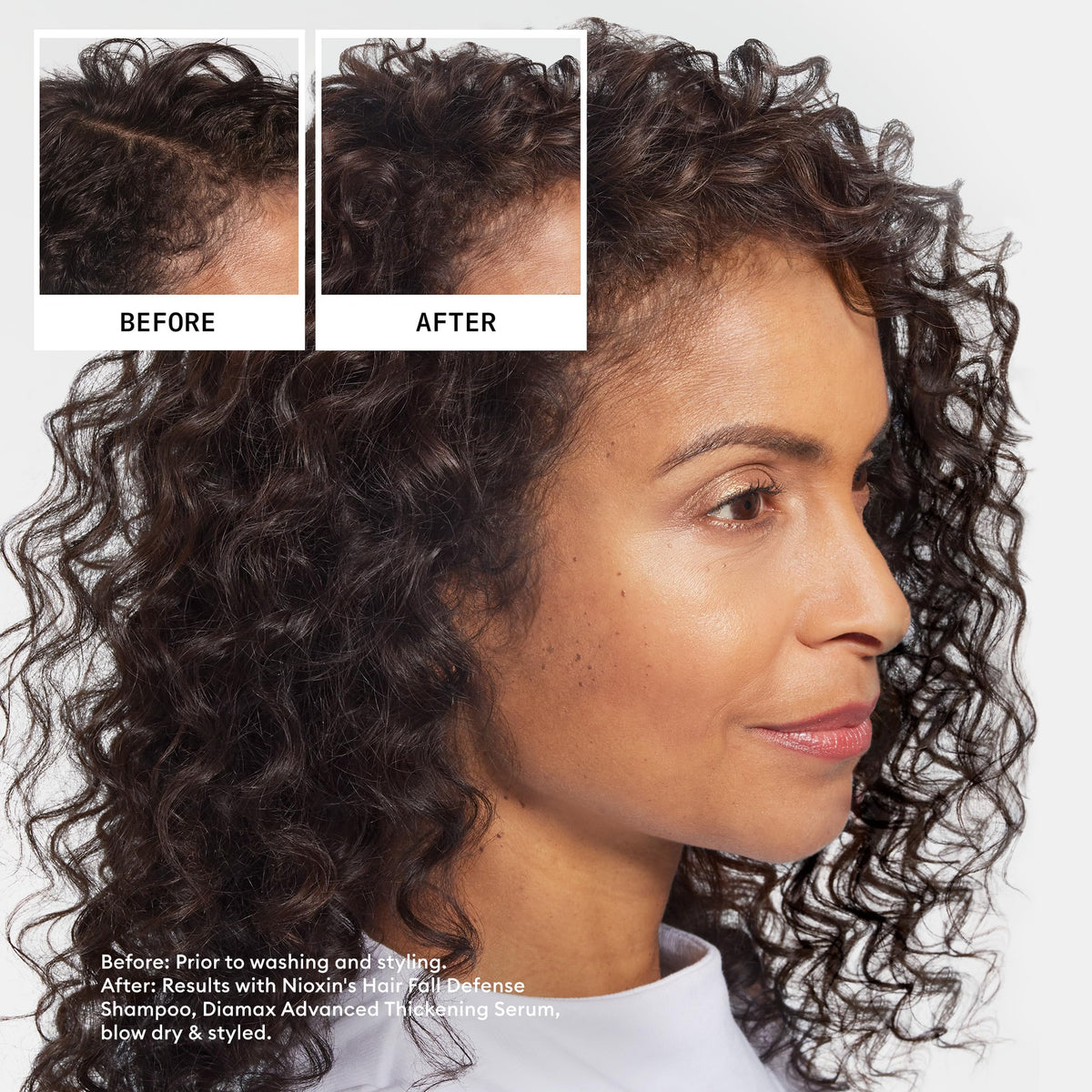 Nioxin Fall Defense Shampoo | Activates Follicles for Visibly Less Hair Loss | With Niacinamide, Caffeine, Lauric Acid & Sandalore | 16 Fl Oz 🍁 All In One Marketplace Canada