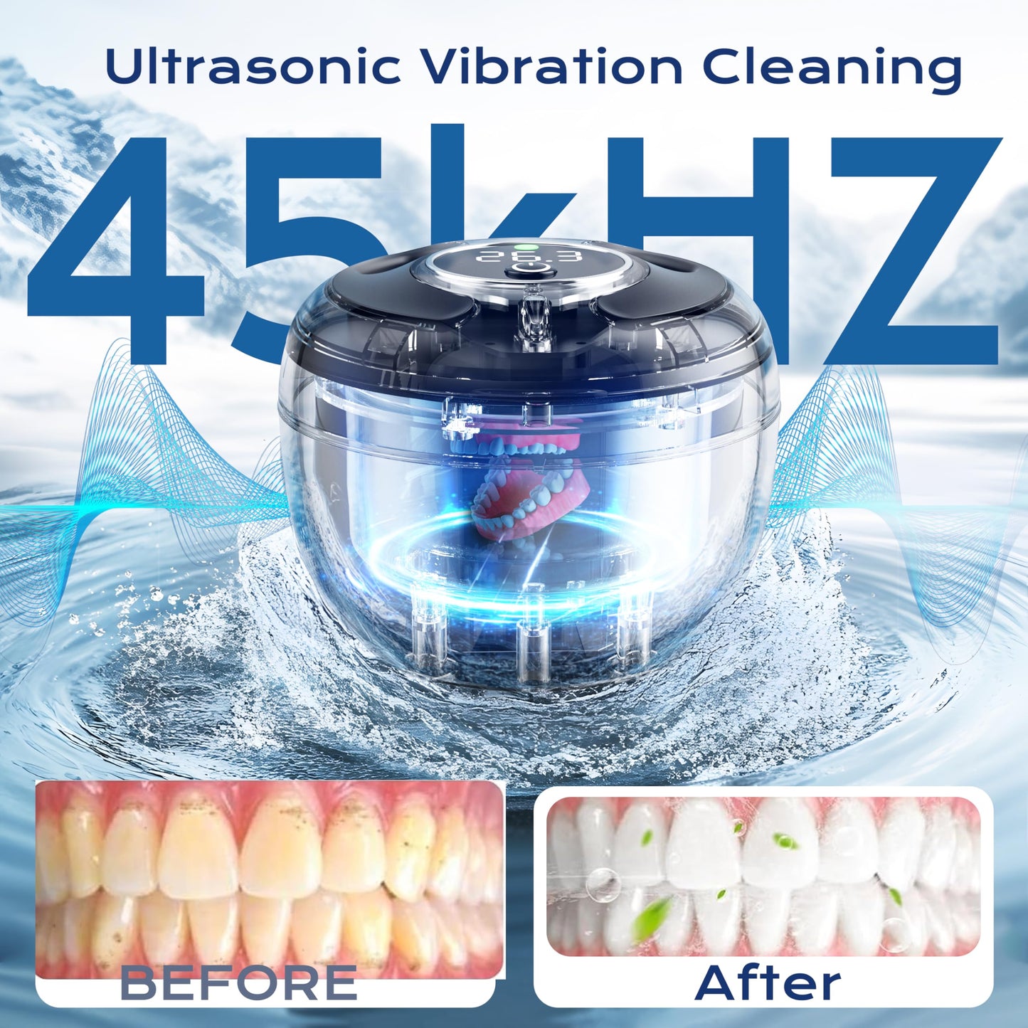 Ultrasonic Retainer Cleaner(2026 Upgraded), 45kHz Cleaning Machine for Dentures, Mouth Guards, Braces, Toothbrush & Jewelry, 200ML Denture Cleaner with 4 Modes for Denture Appliances 🍁 All In One Marketplace Canada