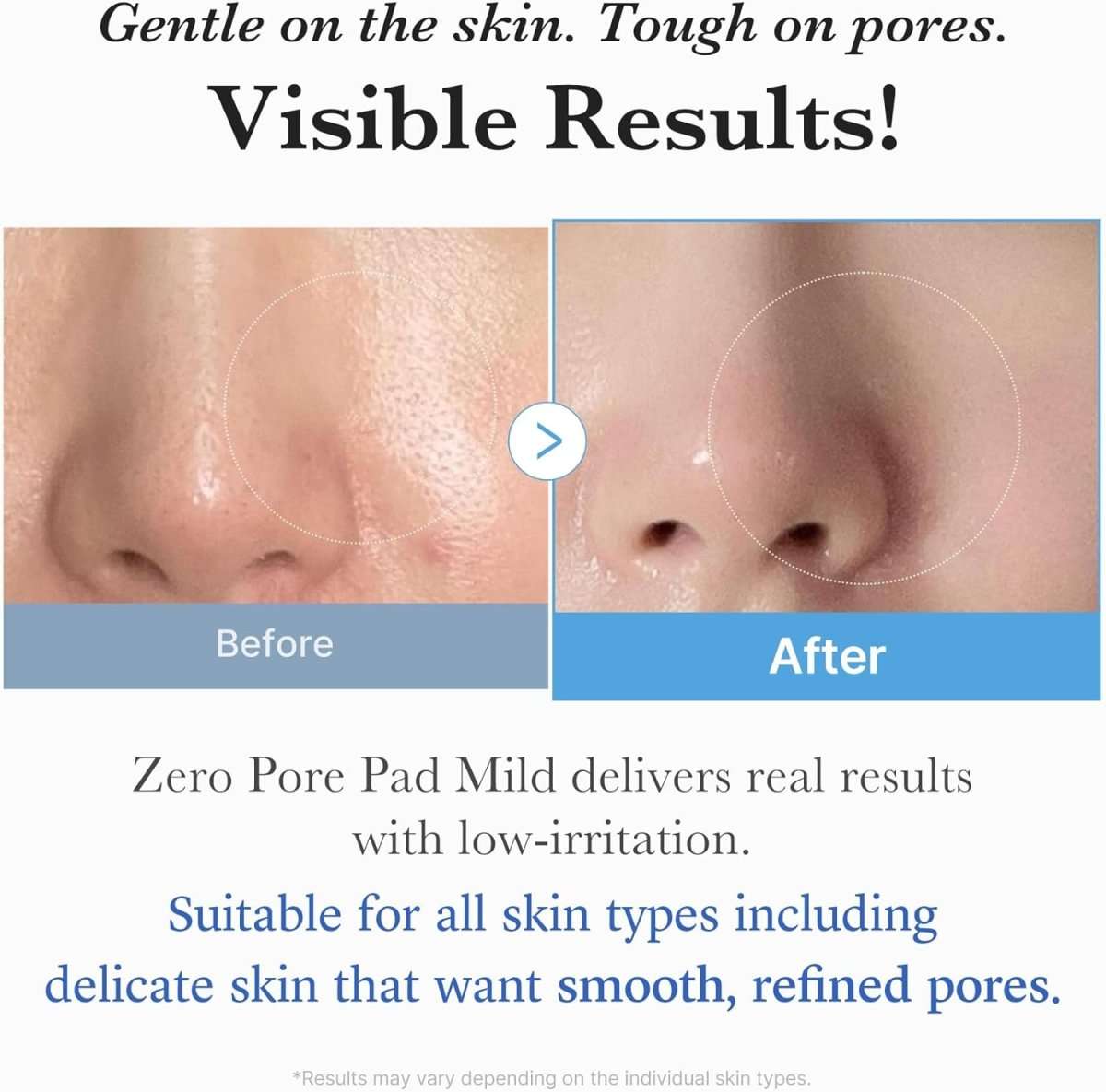 Medicube Zero Pore Mild Pad 155g / 70 pads