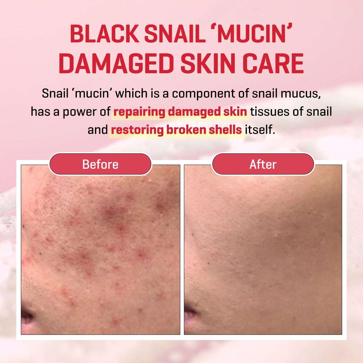 SOME BY MI Snail Truecica Miracle Serum 50ml